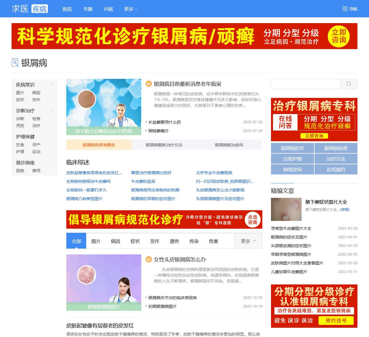 成都银屑病医院-推荐四川治疗银屑病医院_专注牛皮癣等皮肤病